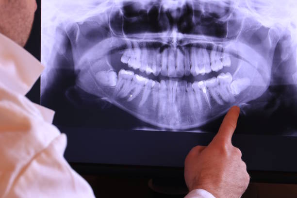 Best Emergency Gum Pain Relief  in Christiana, TN