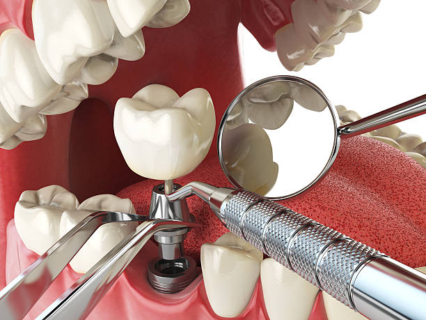 Best Knocked-Out Tooth Emergency  in Christiana, TN